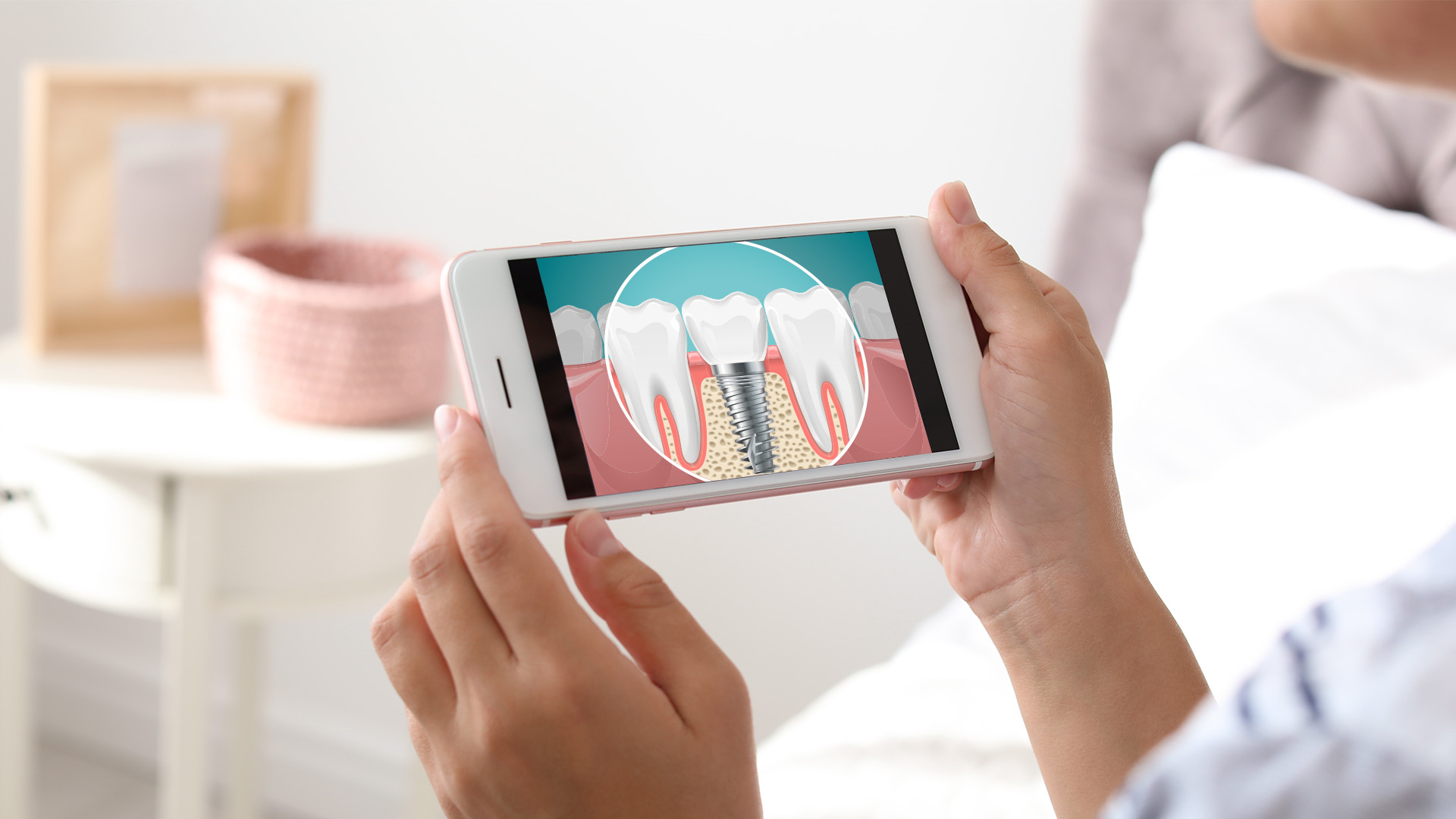 Person holding a smartphone displaying an image of a tooth with a cavity.