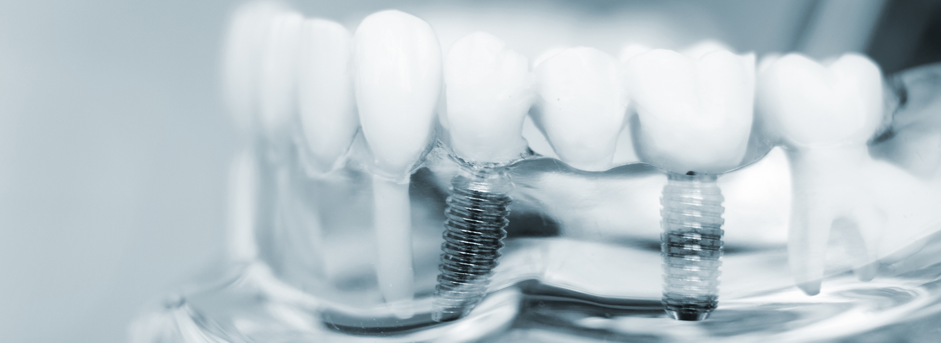 The image displays a close-up view of multiple toothbrushes with bristles against a blurred background.